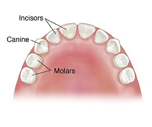 Top view of child's upper jaw showing primary teeth.