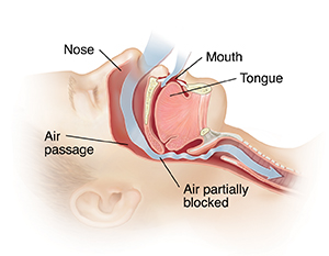 Side view cross section of head showing snoring.